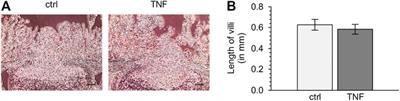 Barrier Perturbation in Porcine Peyer’s Patches by Tumor Necrosis Factor is Associated With a Dysregulation of Claudins